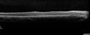 heme_outerretina_fero_032817_06.jpg