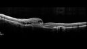 histo_liste1_050119_07.jpg