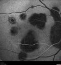 histo_liste1_050119_10.jpg
