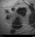 histo_liste1_050119_11.jpg