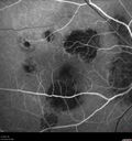 histo_liste1_050119_12.jpg