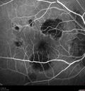histo_liste1_050119_13.jpg