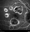 histo_liste1_050119_15.jpg