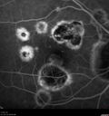 histo_liste1_050119_16.jpg
