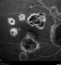 histo_liste1_050119_18.jpg