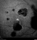 histo_liste1_050119_19.jpg