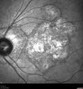 histo_liste1_050119_20.jpg
