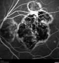histo_liste1_050119_22.jpg