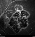 histo_liste1_050119_23.jpg