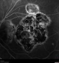 histo_liste1_050119_24.jpg