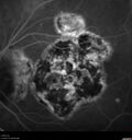 histo_liste1_050119_26.jpg