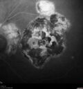 histo_liste1_050119_27.jpg