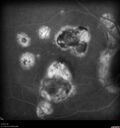 histo_liste1_050119_32.jpg