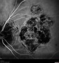 histo_liste1_050119_34.jpg