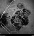 histo_liste1_050119_35.jpg