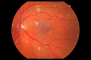 htn_kalo_012816_03.png