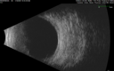 ipcv0_dahuy-preopb-scan-011821_02.png