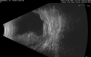 ipcv0_dahuy-preopb-scan-011821_04.png