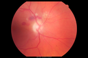 ipcv_doke_090315_02.png