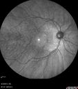 ipcv_joca_040313_07.jpg