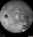 ipcv_joca_040313_08.jpg