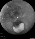 ipcv_joca_040313_09.jpg
