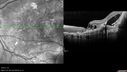 ipcv_joca_040313_18.jpg