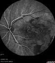 ipcv_joca_040313_23.jpg