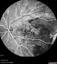 ipcv_joca_040313_24.jpg