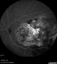 ipcv_joca_040313_29.jpg