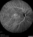 ipcv_joca_040313_32.jpg