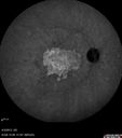 ipcv_joca_040313_35.jpg
