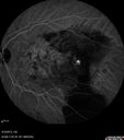 ipcv_joca_040313_41.jpg