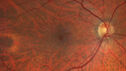 lamellarhole-sturgeweber_riham_111914_01.jpg