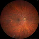 lamellarhole-sturgeweber_riham_111914_02.png
