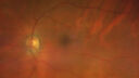 lamellarhole-sturgeweber_riham_111914_03.jpg