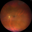 lamellarhole-sturgeweber_riham_111914_04.png