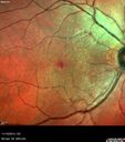 lamellarhole-sturgeweber_riham_111914_05.jpg