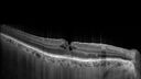 lamellarhole-sturgeweber_riham_111914_07.jpg