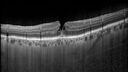 lamellarhole-sturgeweber_riham_111914_08.jpg