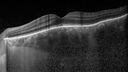 lamellarhole-sturgeweber_riham_111914_09.jpg