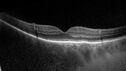 lamellarhole-sturgeweber_riham_111914_10.jpg
