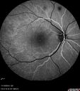 lamellarhole-sturgeweber_riham_111914_12.jpg