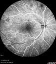 lamellarhole-sturgeweber_riham_111914_14.jpg