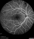 lamellarhole-sturgeweber_riham_111914_15.jpg