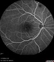 lamellarhole-sturgeweber_riham_111914_16.jpg