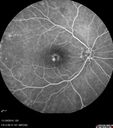 lamellarhole-sturgeweber_riham_111914_18.jpg