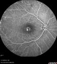 lamellarhole-sturgeweber_riham_111914_19.jpg