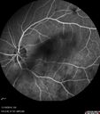 lamellarhole-sturgeweber_riham_111914_20.jpg