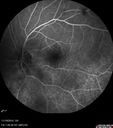 lamellarhole-sturgeweber_riham_111914_21.jpg